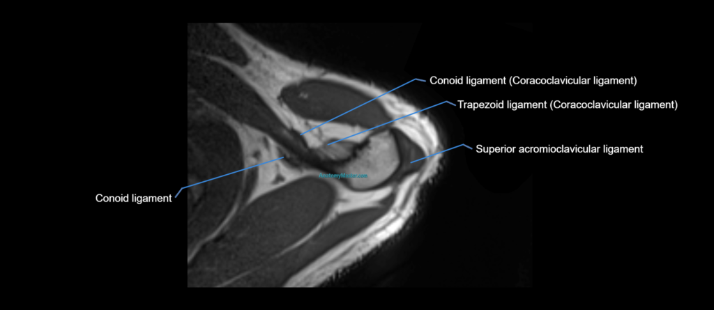 shoulder ligaments axial 3d 3t mri image