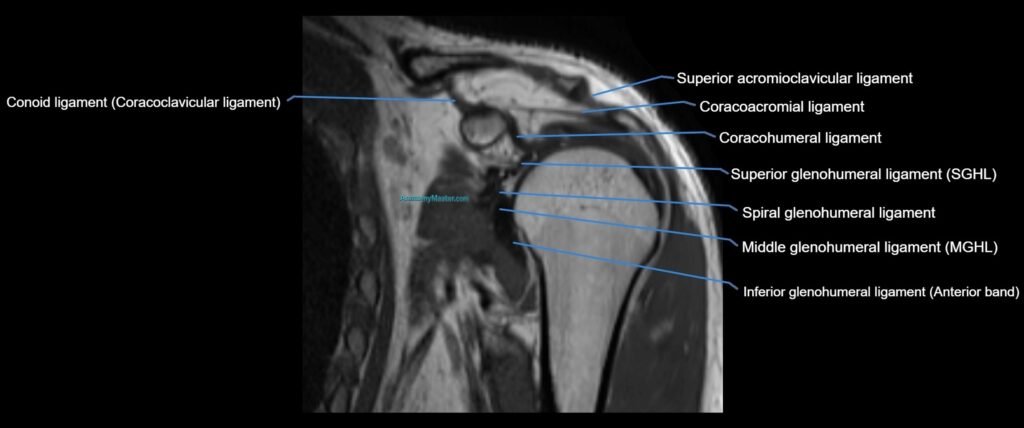 shoulder ligments coronal cross sectional anatomy 3T MRI AI enhanced radiology image