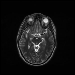 Field of view (FOV) MRI | How to change MRI FOV