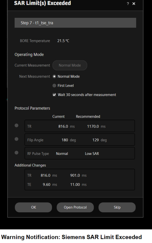 MRI Specific Absorption Rate(SAR) | How To Calculate MRI SAR